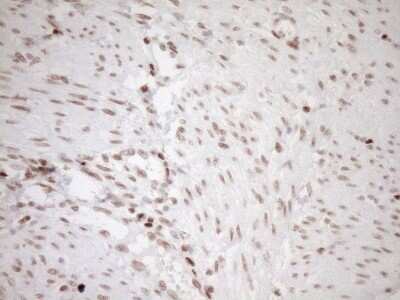 Immunohistochemistry: LXR alpha/NR1H3 Antibody (OTI1A5) - Azide and BSA Free [NBP2-72550] - Analysis of Human endometrium tissue. (Heat-induced epitope retrieval by 1mM EDTA in 10mM Tris buffer (pH8.5) at 120C for 3 min)