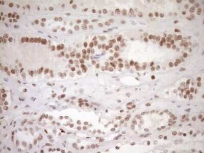 Immunohistochemistry: LXR alpha/NR1H3 Antibody (OTI1A5) - Azide and BSA Free [NBP2-72550] - Analysis of Human Kidney tissue. (Heat-induced epitope retrieval by 1mM EDTA in 10mM Tris buffer (pH8.5) at 120C for 3 min)(1:150)