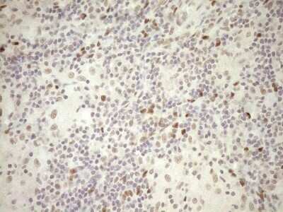 Immunohistochemistry: LXR alpha/NR1H3 Antibody (OTI1A5) - Azide and BSA Free [NBP2-72550] - Analysis of Human lymph node tissue. (Heat-induced epitope retrieval by 1mM EDTA in 10mM Tris buffer (pH8.5) at 120C for 3 min)