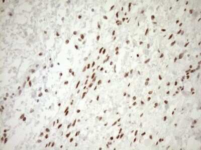 Immunohistochemistry: LXR alpha/NR1H3 Antibody (OTI1A5) - Azide and BSA Free [NBP2-72550] - Analysis of Human Ovary tissue. (Heat-induced epitope retrieval by 1mM EDTA in 10mM Tris buffer (pH8.5) at 120C for 3 min)(1:150)