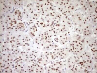 Immunohistochemistry: LXR alpha/NR1H3 Antibody (OTI1A5) - Azide and BSA Free [NBP2-72550] - Analysis of Human pancreas tissue. (Heat-induced epitope retrieval by 1mM EDTA in 10mM Tris buffer (pH8.5) at 120C for 3 min)(1:150)