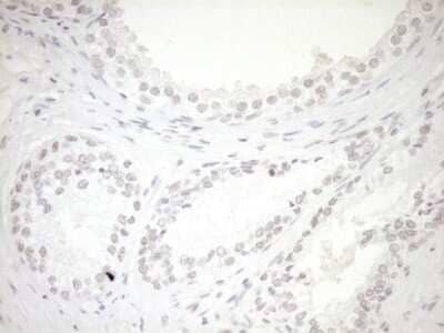 Immunohistochemistry: LXR alpha/NR1H3 Antibody (OTI1A5) - Azide and BSA Free [NBP2-72550] - Analysis of Human prostate tissue. (Heat-induced epitope retrieval by 1mM EDTA in 10mM Tris buffer (pH8.5) at 120C for 3 min)