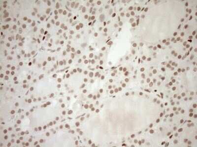 Immunohistochemistry: LXR alpha/NR1H3 Antibody (OTI1A5) - Azide and BSA Free [NBP2-72550] - Analysis of Human thyroid tissue. (Heat-induced epitope retrieval by 1mM EDTA in 10mM Tris buffer (pH8.5) at 120C for 3 min)(1:150)