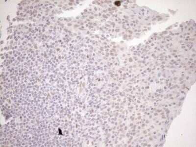 Immunohistochemistry: LXR alpha/NR1H3 Antibody (OTI1A5) - Azide and BSA Free [NBP2-72550] - Analysis of Human tonsil tissue. (Heat-induced epitope retrieval by 1mM EDTA in 10mM Tris buffer (pH8.5) at 120C for 3 min)