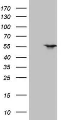 Western Blot: LXR alpha/NR1H3 Antibody (OTI1A5) - Azide and BSA Free [NBP2-72550] - Analysis of HEK293T cells were transfected with the pCMV6-ENTRY control (Left lane) or pCMV6-ENTRY LXR.