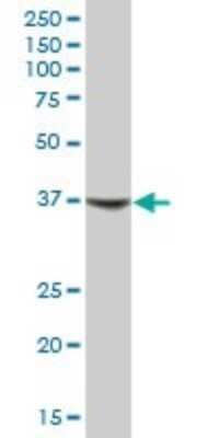 Western Blot: LXR alpha/NR1H3 Antibody [H00010062-B01P] - Analysis of NR1H3 expression in human liver.