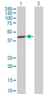 Western Blot: LXR alpha/NR1H3 Antibody [H00010062-D01P] - Analysis of NR1H3 expression in transfected 293T cell line by NR1H3 polyclonal antibody.Lane 1: NR1H3 transfected lysate(45.70 KDa).Lane 2: Non-transfected lysate.