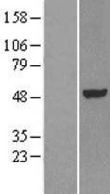 Western Blot LXR alpha/NR1H3 Overexpression Lysate