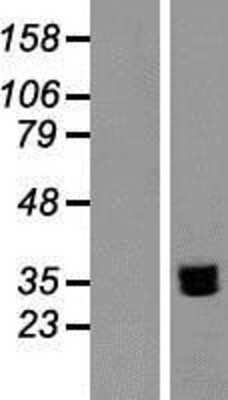Western Blot NTB-A/SLAMF6/CD352 Overexpression Lysate