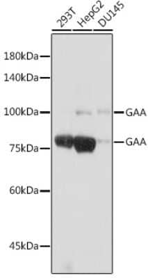 Western Blot: LYAG/GAA Antibody (5L2L10) [NBP3-15698] - Western blot analysis of extracts of various cell lines, using LYAG/GAA antibody (NBP3-15698) at 1:1000 dilution. Secondary antibody: HRP Goat Anti-Rabbit IgG (H+L) at 1:10000 dilution. Lysates/proteins: 25ug per lane. Blocking buffer: 3% nonfat dry milk in TBST. Detection: ECL Basic Kit. Exposure time: 10s.