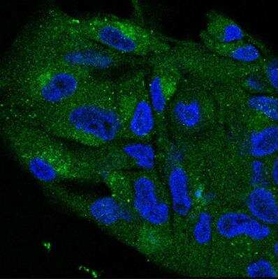 Immunocytochemistry/Immunofluorescence: LYAG/GAA Antibody [NBP1-69295] - LYAG was probed in human fibroblasts fixed with 4% PFA. Cells were permeabilized and blocked in 0.1% Tween and 1% Bovine serum albumin. Anti-LYAG was incubated overnight at 4C in PBS with 0.1% Tween and 1% Bovine serum albumin. Secondary antibody was anti-rabbit conjugated to Alexa Fluor 568. LYAG is shown in green and the nucleus in blue (Hoescht stain). Image is courtesy of customer review.