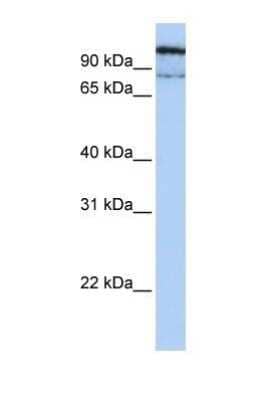 Western Blot: LYAG/GAA Antibody [NBP1-69295] - This Anti-GAA antibody was used in Western Blot of MCF7 tissue lysate at a concentration of 1ug/ml.