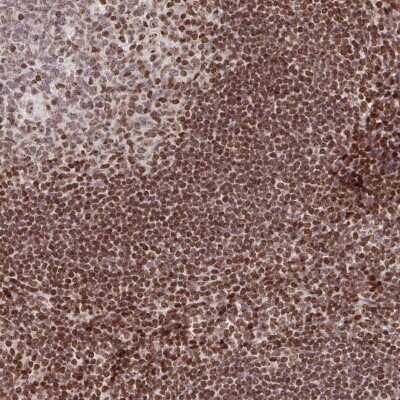 Immunohistochemistry-Paraffin: LYDG10 Antibody [NBP2-31849] - Staining of human tonsil shows strong nuclear positivity in,non-germinal center cells, germinal center cells were moderately stained. .