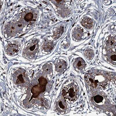 Immunohistochemistry-Paraffin: LYG2 Antibody [NBP1-81278] - Staining of human breast shows moderate cytoplasmic positivity in glandular cells and distinct positivity in extracellular material.