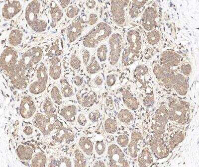 Immunohistochemistry-Paraffin: LYG2 Antibody [NBP3-12638] - Staining of human LYG2 in human breast with rabbit polyclonal antibody at 1:100 dilution.