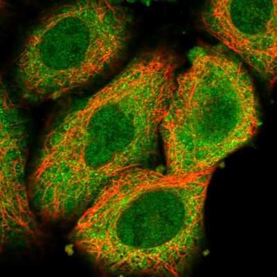 Immunocytochemistry/Immunofluorescence: LYK5 Antibody [NBP1-89577] - Immunofluorescent staining of human cell line A549 shows localization to nucleoplasm & cytosol.