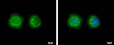 Immunocytochemistry/Immunofluorescence: LYK5 Antibody [NBP2-17187] - Analysis of MCF-7 cells. Green: LYK5 protein stained by LYK5 antibody diluted at 1:500. Blue: Hoechst 33342 staining.