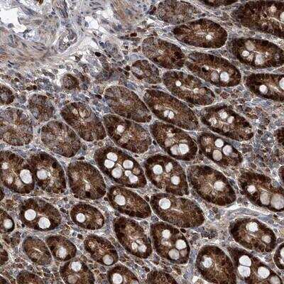 Immunohistochemistry: LYK5 Antibody [NBP1-89577] - Staining of human duodenum shows strong cytoplasmic and nuclear positivity in glandular cells.