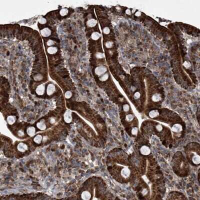 Immunohistochemistry-Paraffin: LYK5 Antibody [NBP1-89577] - Staining of human duodenum shows strong cytoplasmic and nuclear positivity in glandular cells.