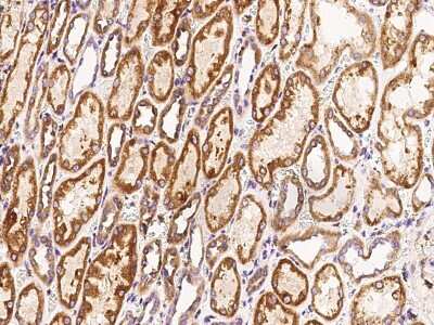 Immunohistochemistry-Paraffin: LYK5 Antibody [NBP2-99336] - Immunochemical staining of human LYK5 in human kidney with rabbit polyclonal antibody at 1:300 dilution, formalin-fixed paraffin embedded sections.