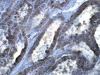 Immunohistochemistry-Paraffin: LYK5 Antibody [NBP3-12322] - Baboon Kidney.  1:100 dilution in IHC blocking buffer. DAB (brown) staining and Hematoxylin QS (blue) counterstain. 40X magnification.