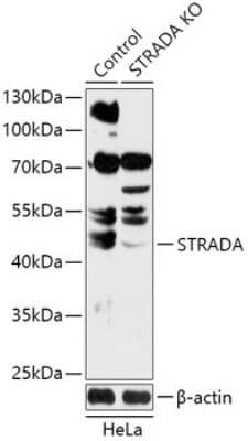 Western Blot: LYK5 Antibody [NBP3-03612] - Analysis of extracts from normal (control) and STRADA knockout (KO) HeLa cells, using LYK5 antibody at 1:1000 dilution. Secondary antibody: HRP Goat Anti-Rabbit IgG (H+L) at 1:10000 dilution. Lysates/proteins: 25ug per lane. Blocking buffer: 3% nonfat dry milk in TBST.