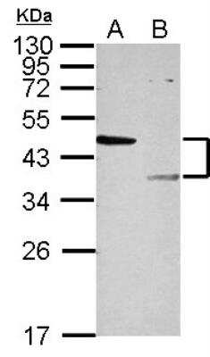 Western Blot: LYK5 Antibody [NBP2-17187] - Sample (30 ug of whole cell lysate)  A: 293T  B: HepG2  12% SDS PAGE   diluted at 1:1000 