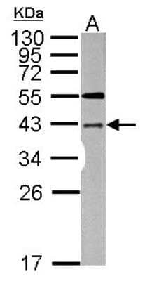 Western Blot LYK5 Antibody