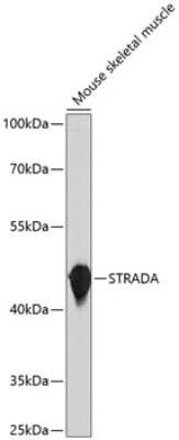 Western Blot: LYK5 Antibody [NBP3-03613] - Analysis of extracts of Mouse skeletal muscle, using LYK5 antibody at 1:1000 dilution. Secondary antibody: HRP Goat Anti-Rabbit IgG (H+L) at 1:10000 dilution. Lysates/proteins: 25ug per lane. Blocking buffer: 3% nonfat dry milk in TBST. Detection: ECL Basic Kit.