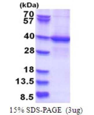 SDS-Page: LYK5 Recombinant Protein [NBP2-51734] - 15% SDS Page (3 ug)