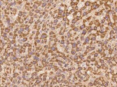 Immunohistochemistry-Paraffin: LYPD2 Antibody [NBP3-06039] - Staining of human LYPD2 in human liver with rabbit polyclonal antibody at 1:100 dilution.