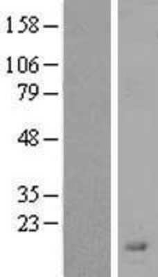 Western Blot: LYPD2 Overexpression Lysate (Adult Normal) [NBP2-04546] Left-Empty vector transfected control cell lysate (HEK293 cell lysate); Right -Over-expression Lysate for LYPD2.
