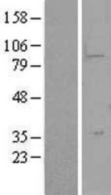 Western Blot: LYPD5 Overexpression Lysate (Adult Normal) [NBP2-04445] Left-Empty vector transfected control cell lysate (HEK293 cell lysate); Right -Over-expression Lysate for LYPD5.
