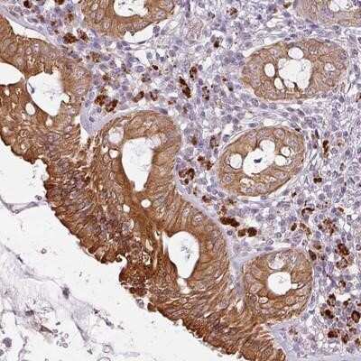 Immunohistochemistry-Paraffin: LYPLA1 Antibody [NBP2-14209] - Staining of human rectum shows strong cytoplasmic and membranous positivity in glandular cells.