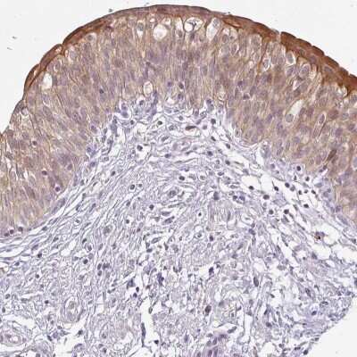 Immunohistochemistry-Paraffin: LYPLA1 Antibody [NBP2-14209] - Staining of human urinary bladder shows high expression.