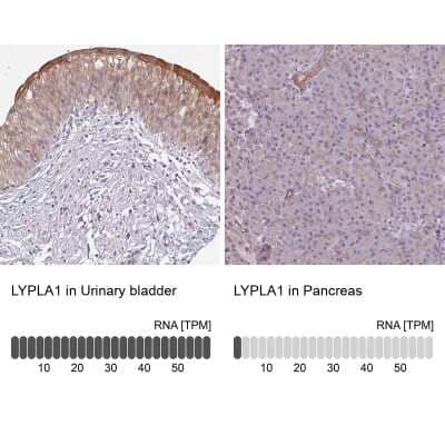 <b>Orthogonal Strategies Validation. </b>Immunohistochemistry-Paraffin: LYPLA1 Antibody [NBP2-14209] - Staining in human urinary bladder and pancreas tissues using anti-LYPLA1 antibody. Corresponding LYPLA1 RNA-seq data are presented for the same tissues.