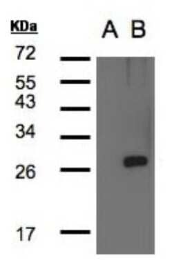 Western Blot: LYPLA1 Antibody [NBP2-17191] - Analysis of LYPLA1 expression in transfected 293T cell line by LYPLA1polyclonal antibody. A: Non-transfected lysate. B: LYPLA1 transfected lysate. 12% SDS PAGE gel, diluted at 1:500.