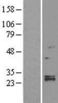 Western Blot: LYPLA1 Overexpression Lysate (Adult Normal) [NBL1-12760] Left-Empty vector transfected control cell lysate (HEK293 cell lysate); Right -Over-expression Lysate for LYPLA1.