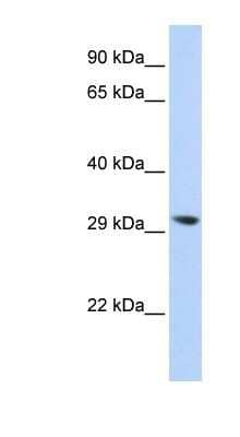 Western Blot: LYPLA2 Antibody [NBP1-56653] - Titration: 0.2-1 ug/ml, Positive Control: 293T cell lysate.