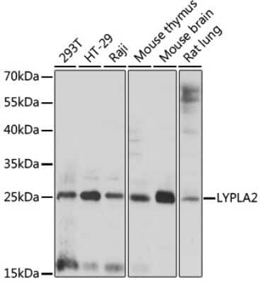 Western Blot: LYPLA2 Antibody [NBP3-04729] - Analysis of extracts of various cell lines, using LYPLA2 antibody at 1:1000 dilution. Secondary antibody: HRP Goat Anti-Rabbit IgG (H+L) at 1:10000 dilution. Lysates/proteins: 25ug per lane. Blocking buffer: 3% nonfat dry milk in TBST. Detection: ECL Enhanced Kit