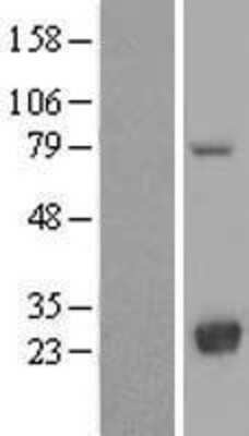 Western Blot: LYPLA2 Overexpression Lysate (Adult Normal) [NBL1-12761] Left-Empty vector transfected control cell lysate (HEK293 cell lysate); Right -Over-expression Lysate for LYPLA2.