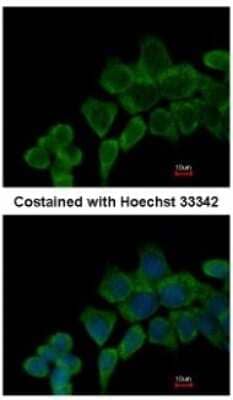 Immunocytochemistry/Immunofluorescence: LYPLA3 Antibody [NBP2-17193] - Analysis of methanol-fixed A431, using antibody at 1:200 dilution.