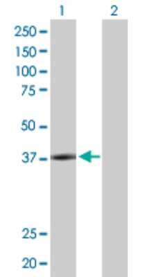 Western Blot: LYPLA3 Antibody [H00023659-D01P] - Analysis of PLA2G15 expression in transfected 293T cell line by PLA2G15 polyclonal antibody.Lane 1: LYPLA3 transfected lysate(46.70 KDa).Lane 2: Non-transfected lysate.