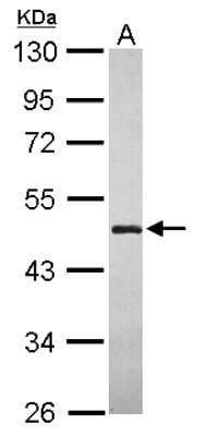 Western Blot: LYPLA3 Antibody [NBP2-17192] - Sample (30 ug of whole cell lysate) A: Hep G2 10% SDS PAGE gel, diluted at 1:1000.
