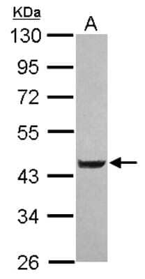 Western Blot: LYPLA3 Antibody [NBP2-17193] - Sample (30 ug of whole cell lysate) A: Jurkat 10% SDS PAGE gel, diluted at 1:2000.