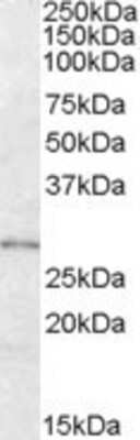 Western Blot: LYPLAL1 Antibody [NBP1-00210] - Analysis of LYPLAL1 in Human Adipose lysate (35ug protein in RIPA buffer) using this antibody at 0.3 ug/ml. Primary incubation was 1 hour. Detected by chemiluminescence.