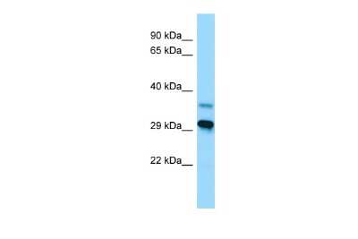 Western Blot: LYPLAL1 Antibody [NBP2-85245] - WB Suggested Anti-LYPLAL1 Antibody. Titration: 1.0 ug/ml. Positive Control: Placenta