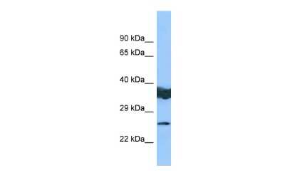 Western Blot: LYPLAL1 Antibody [NBP2-85246] - WB Suggested Anti-LYPLAL1 Antibody. Titration: 1.0 ug/ml. Positive Control: COLO205 Whole Cell