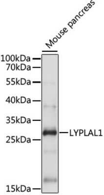 Western Blot: LYPLAL1 Antibody [NBP3-03916] - Analysis of extracts of Mouse pancreas, using LYPLAL1 antibody at 1:1000 dilution. Secondary antibody: HRP Goat Anti-Rabbit IgG (H+L) at 1:10000 dilution. Lysates/proteins: 25ug per lane. Blocking buffer: 3% nonfat dry milk in TBST. Detection: ECL Basic Kit.