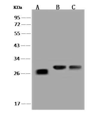 Western Blot: LYPLAL1 Antibody [NBP3-06252] - Anti-LYPLAL1 rabbit polyclonal antibody at 1:500 dilutionLane A: COCLO205 Whole Cell LysateLane B: RT-4 Whole Cell LysateLane C: U-251MG Whole Cell LysateLysatesroteins at 30 ug per lane.SecondaryGoat Anti-Rabbit IgG (H+L)HRP   at 110000 dilution.Developed using the ECL technique.Performed under reducing conditions.Predicted band size:26 kDa